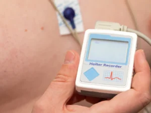 Understanding the Holter Monitor Test Heart Matters