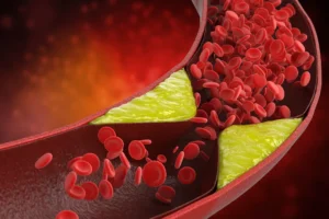 Understanding Cardiovascular Risk Factors Heart Matters