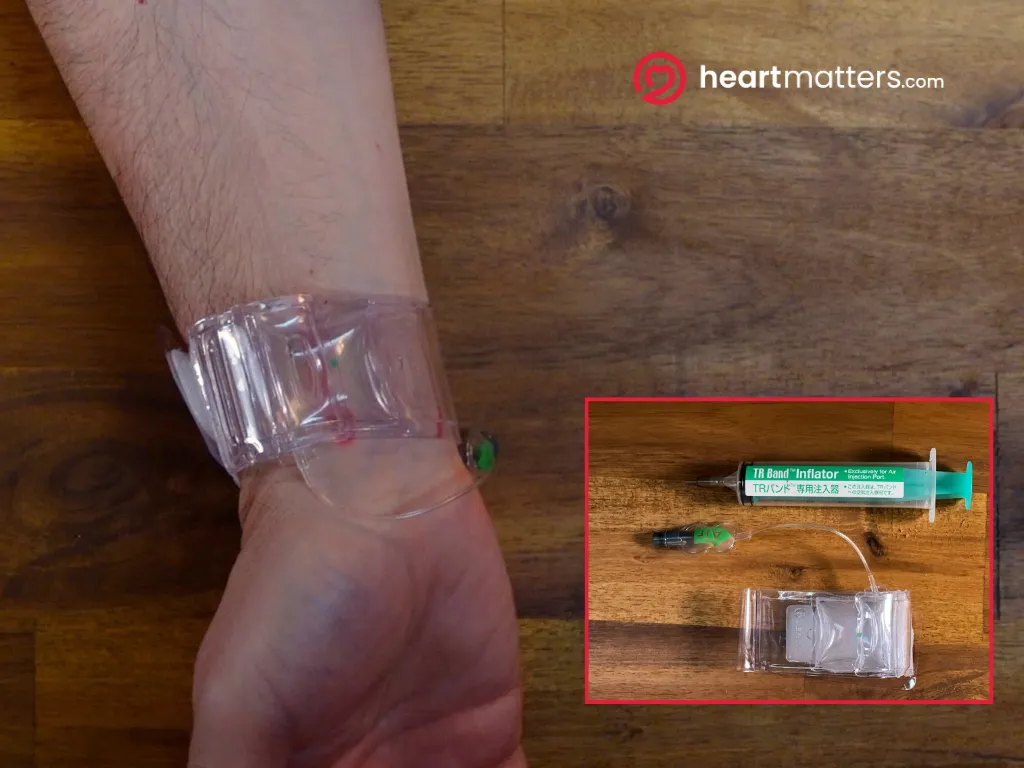 TR band radial compression device on wrist after coronary angiogram, used to seal the radial artery puncture site