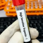 Troponin: The Blood Test at the Heart of Chest Pain Assessment