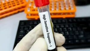What Is a Troponin Test, and Why Is It Used for Chest Pain?