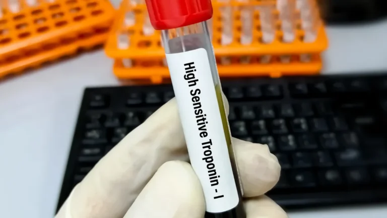 Troponin: The Blood Test at the Heart of Chest Pain Assessment