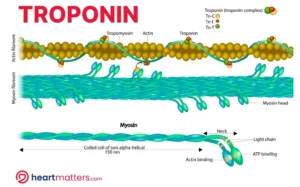 Understanding Troponin: A Vital Marker in Cardiology Heart Matters