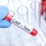 The hs-CRP Test — Inflammation, Heart Risk, and Why Context Matters