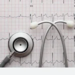 The Electrocardiogram (ECG / EKG)