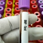 What Is a BNP Test? Understanding This Key Heart Failure Blood Test