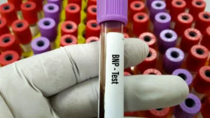 What Is a BNP Test? Understanding This Key Heart Failure Blood Test