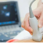Patent Foramen Ovale (PFO): What the “Hole in the Heart” Finding Really Means