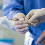 Coronary Artery Bypass Grafting (CABG): What to Expect