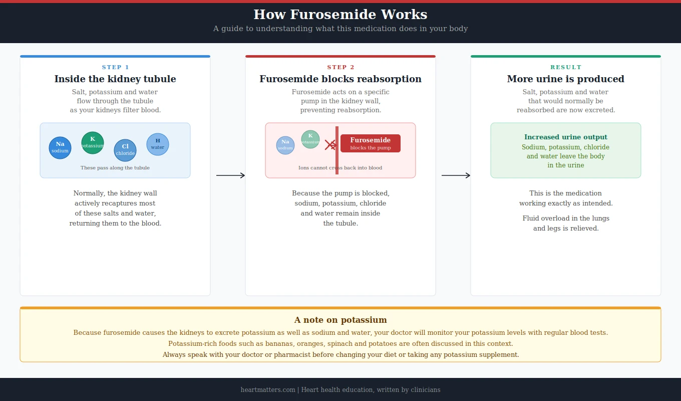 Furosemide (Frusemide) Explained 2 How furosemide works in the kidney, a three step diagram showing sodium, potassium and water being blocked from reabsorption and passing into urine