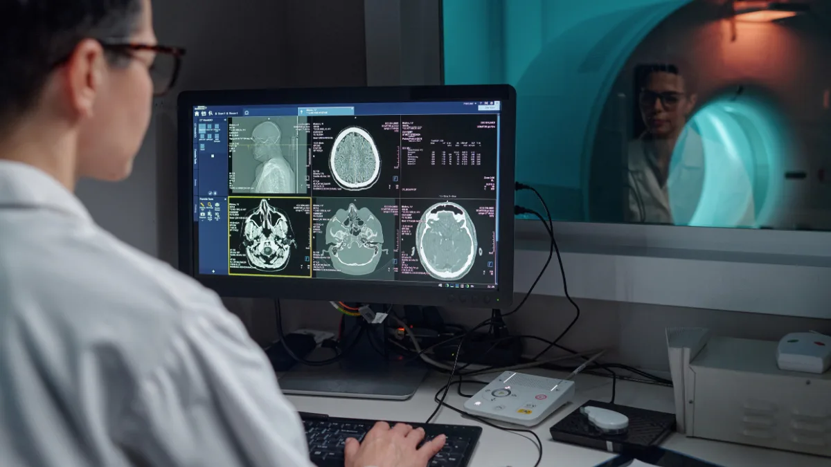 Brain MRI scans showing imaging used after stroke and TIA assessment