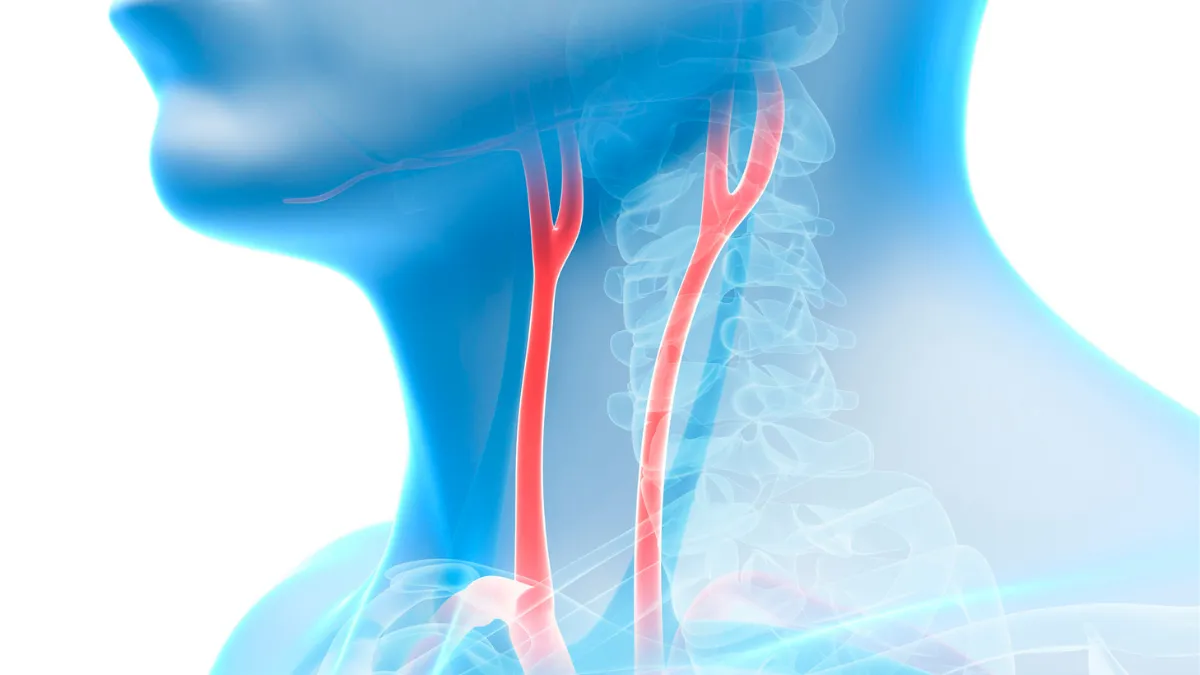 Illustration of the carotid arteries arising from the aorta and supplying blood to the brain