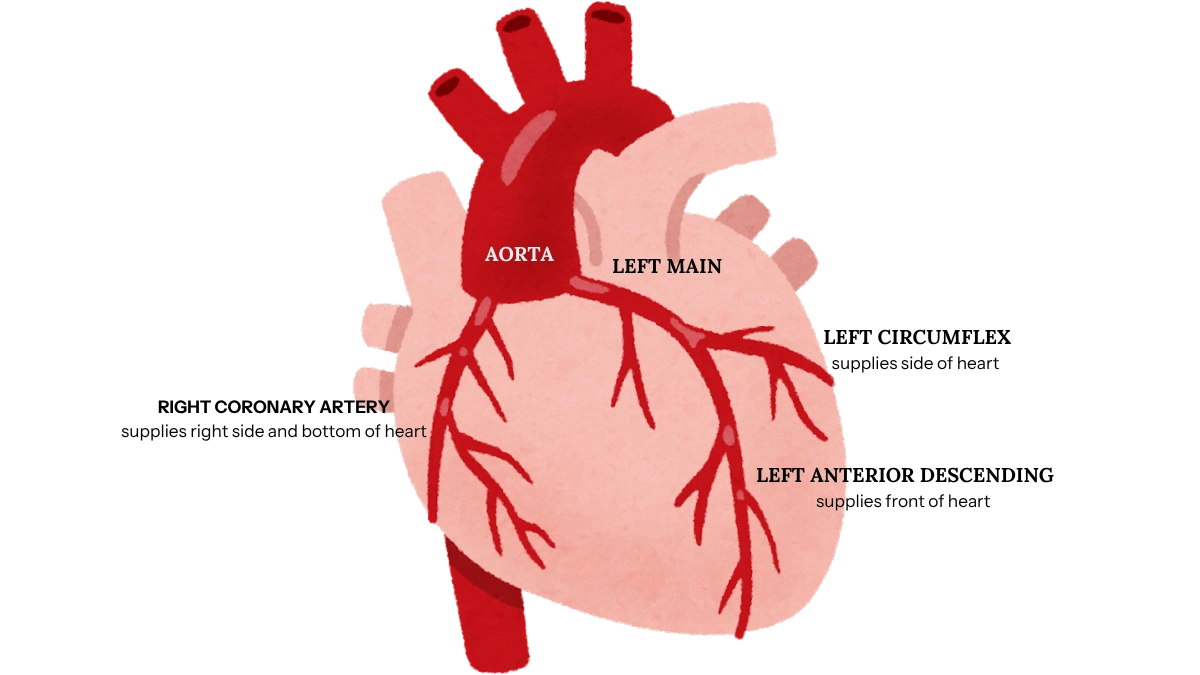 Diagram of the heart showing the three main coronary arteries — LAD, LCx, and RCA — as seen in anterior view