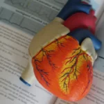 What is a Muscle Bridge?