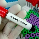 ApoB Explained: What It Measures and Why LDL Still Matters