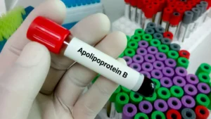 ApoB Explained: What It Measures and Why LDL Still Matters