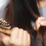 The Hair Loss Question