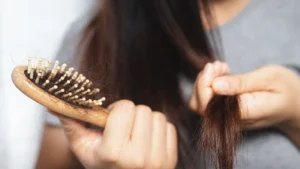 The Hair Loss Question
