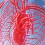 Aortic Dissection: The Chest Pain That Cannot Wait