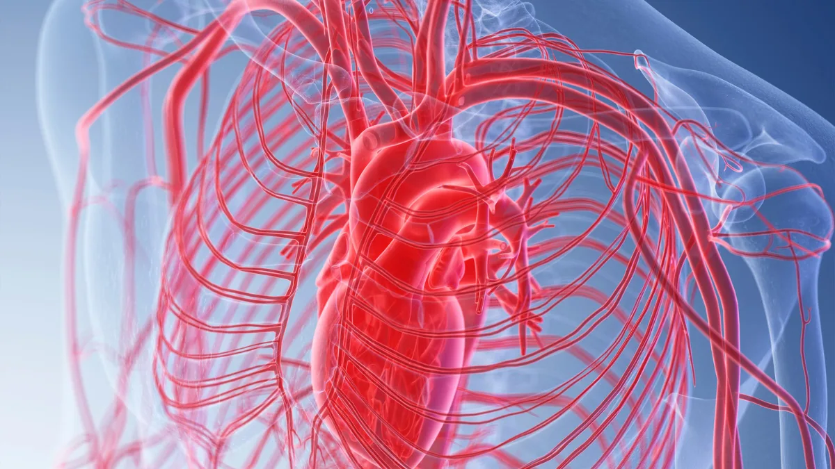 aortic dissection