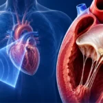 Infective Endocarditis: The Fever That Needs Explaining