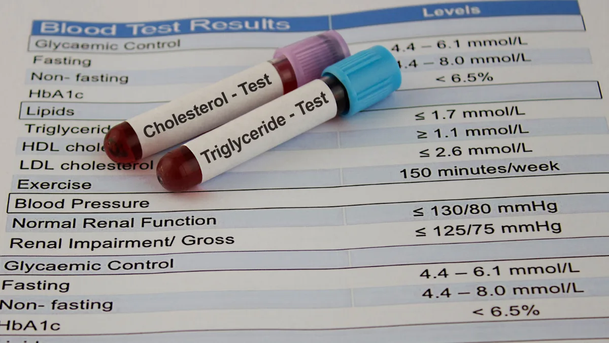 cholesterol test